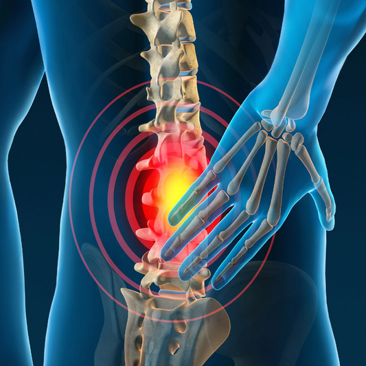 6 Effective Ways to Reduce Back Pain